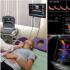 Ultrazvučno duplex skeniranje brahiocefaličnih arterija