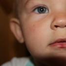 Asiklovir untuk bayi: apakah bisa digunakan?